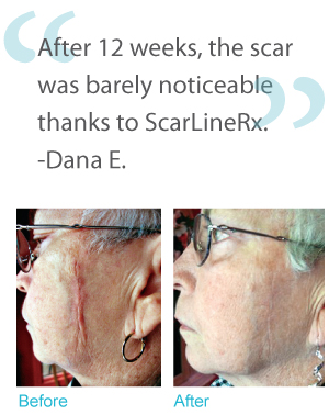 ScarLine Testimonial